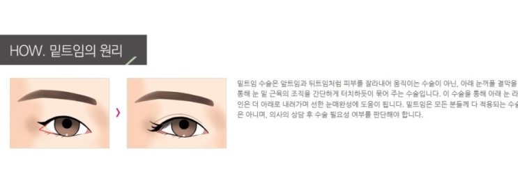 센트럴성형외과 이미지