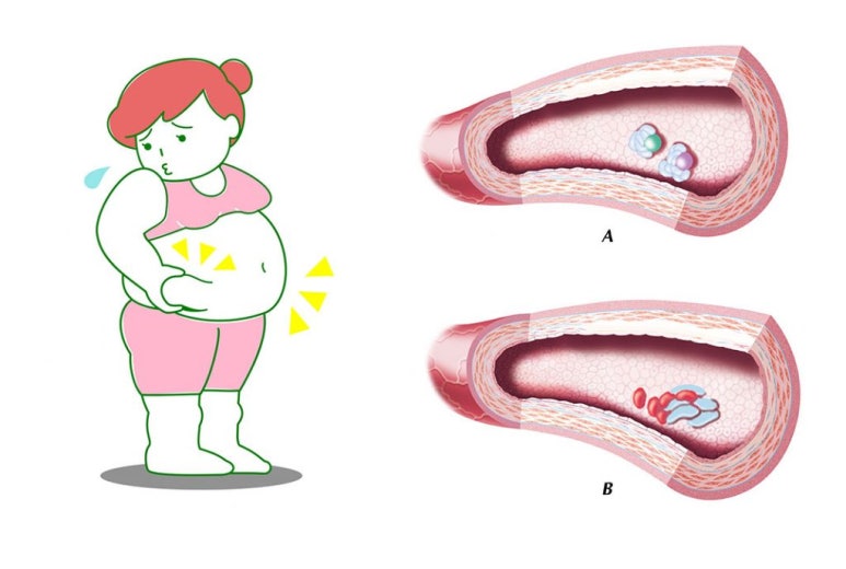 베어리핏 이미지