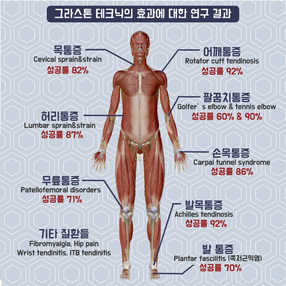서일교정형외과 이미지