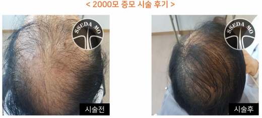 쎄다모 이미지