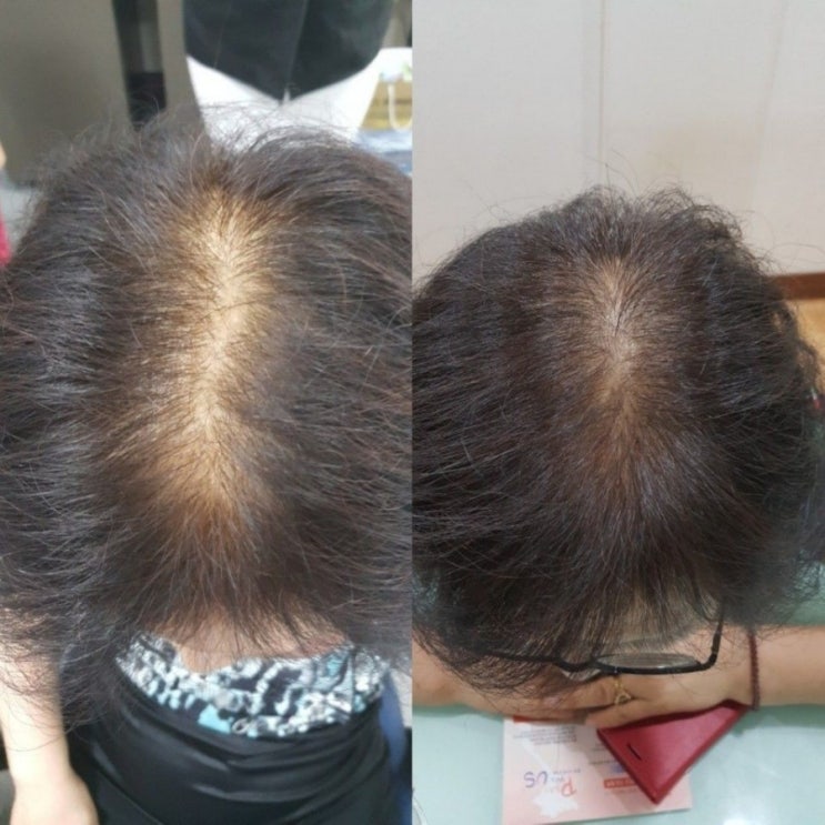 리뉴메디 이미지