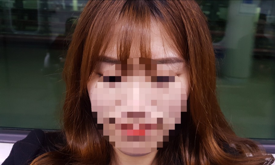 정현 헤어크리닉 이미지