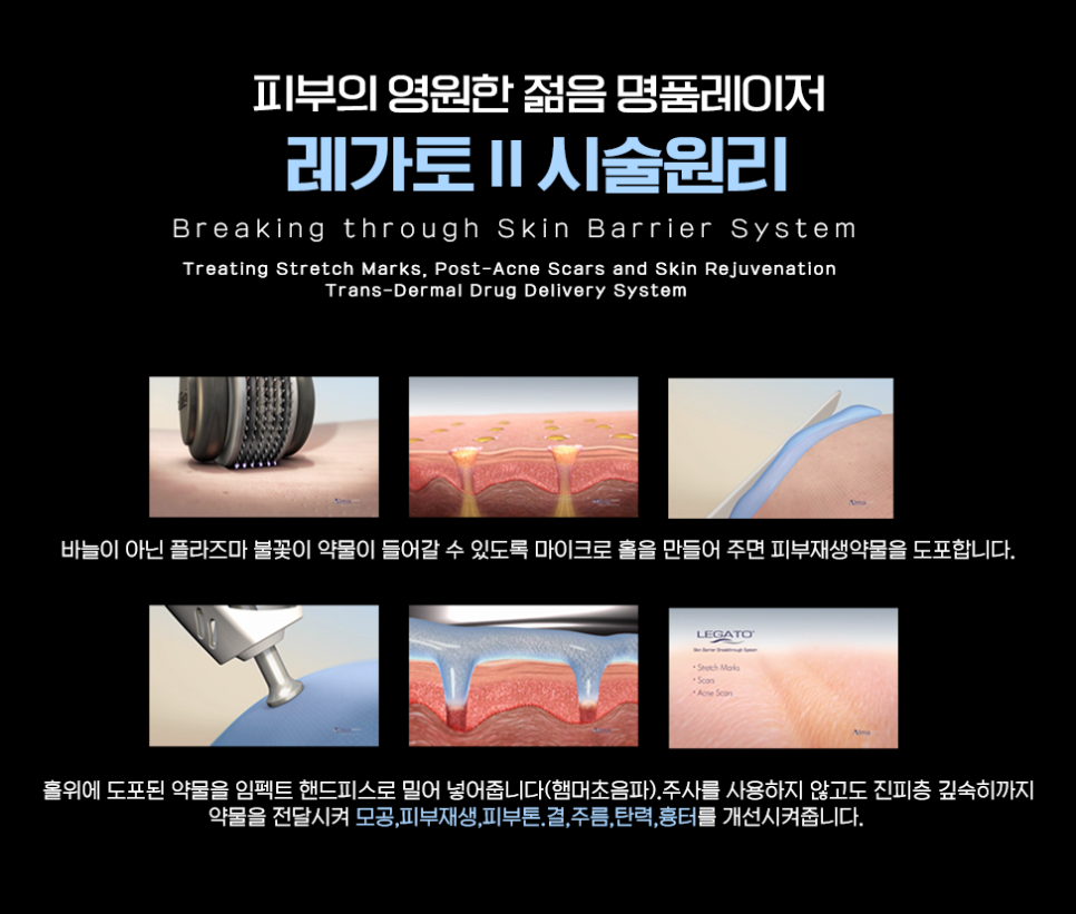 레가토 이미지