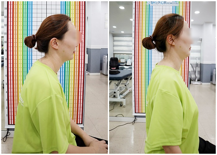 엔씨알 이미지