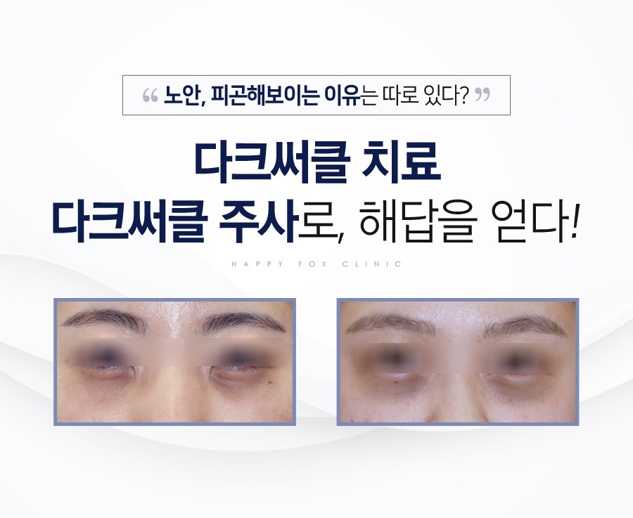 행복한여우의원 이미지