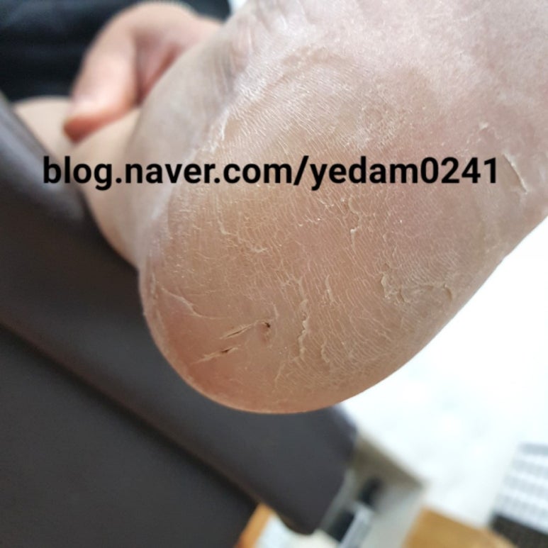 예담네일 이미지