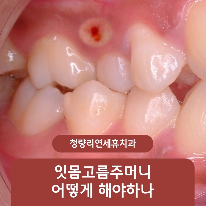 청량리연세제일치과 이미지