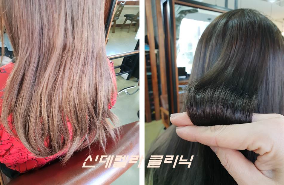 퀸헤어클리닉 이미지