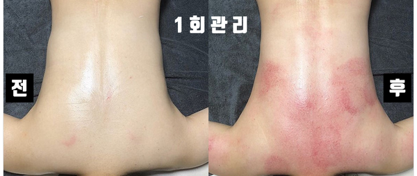 허리천사 이미지