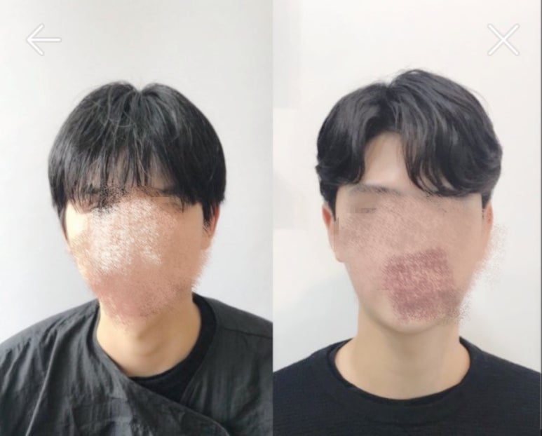 라엘헤어 이미지