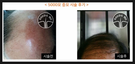쎄다모 이미지