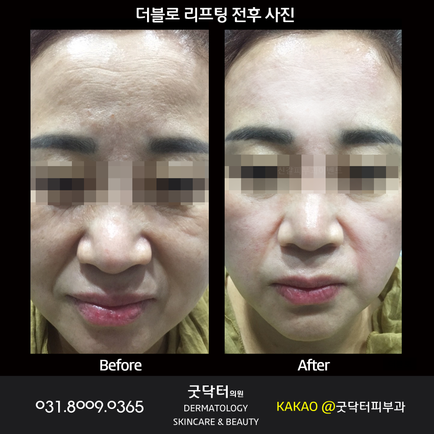 굿페이스의원 이미지