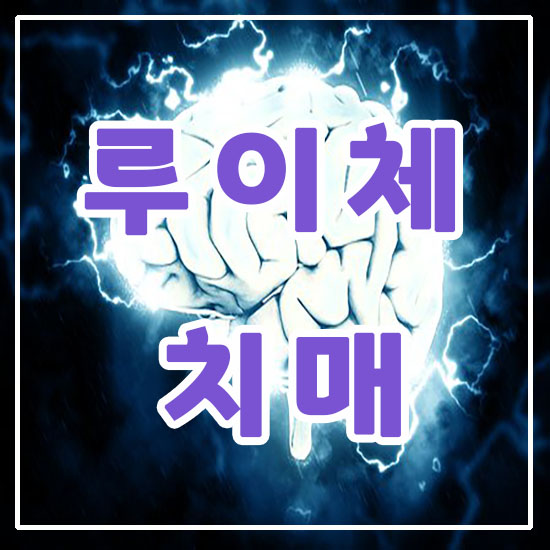 루이체 이미지