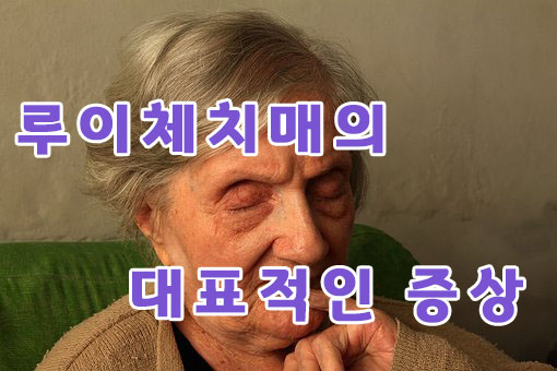 루이체 이미지