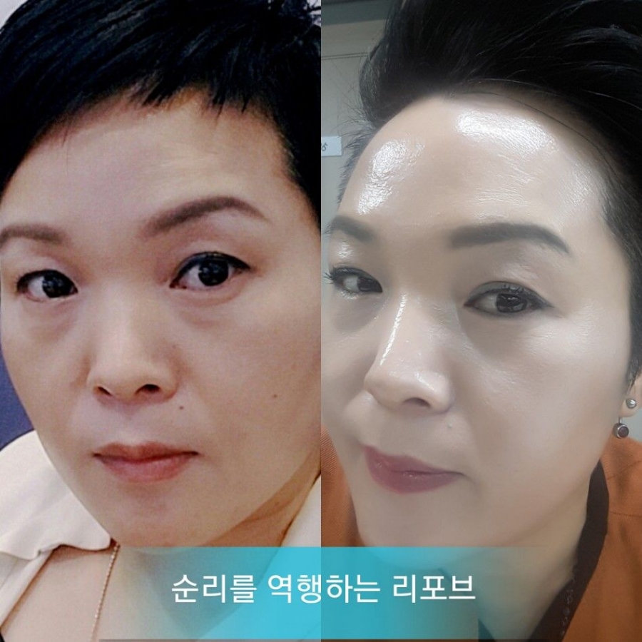 뷰티아이 이미지