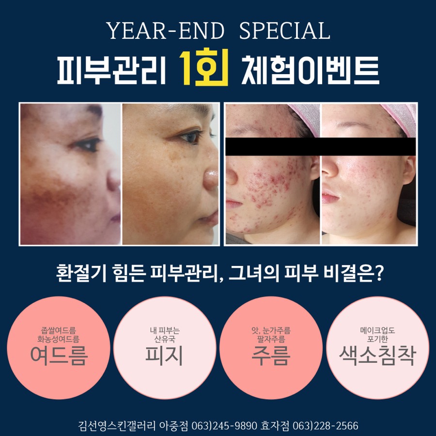 스킨갤러리 이미지