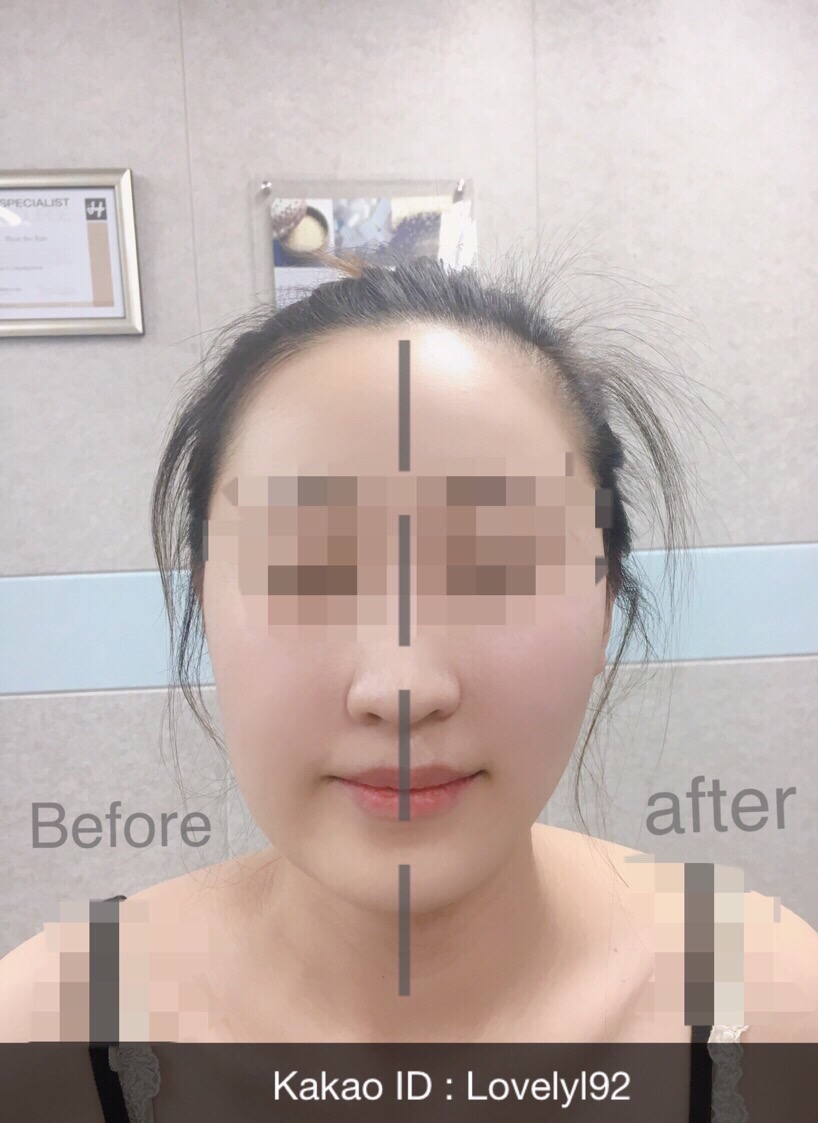 러블리엘 이미지