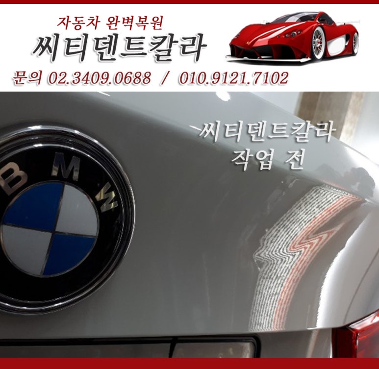 씨티덴트 이미지