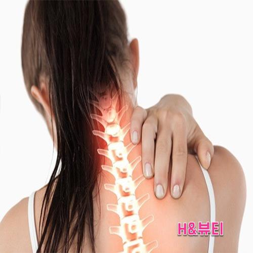 피부 스트레칭 이미지