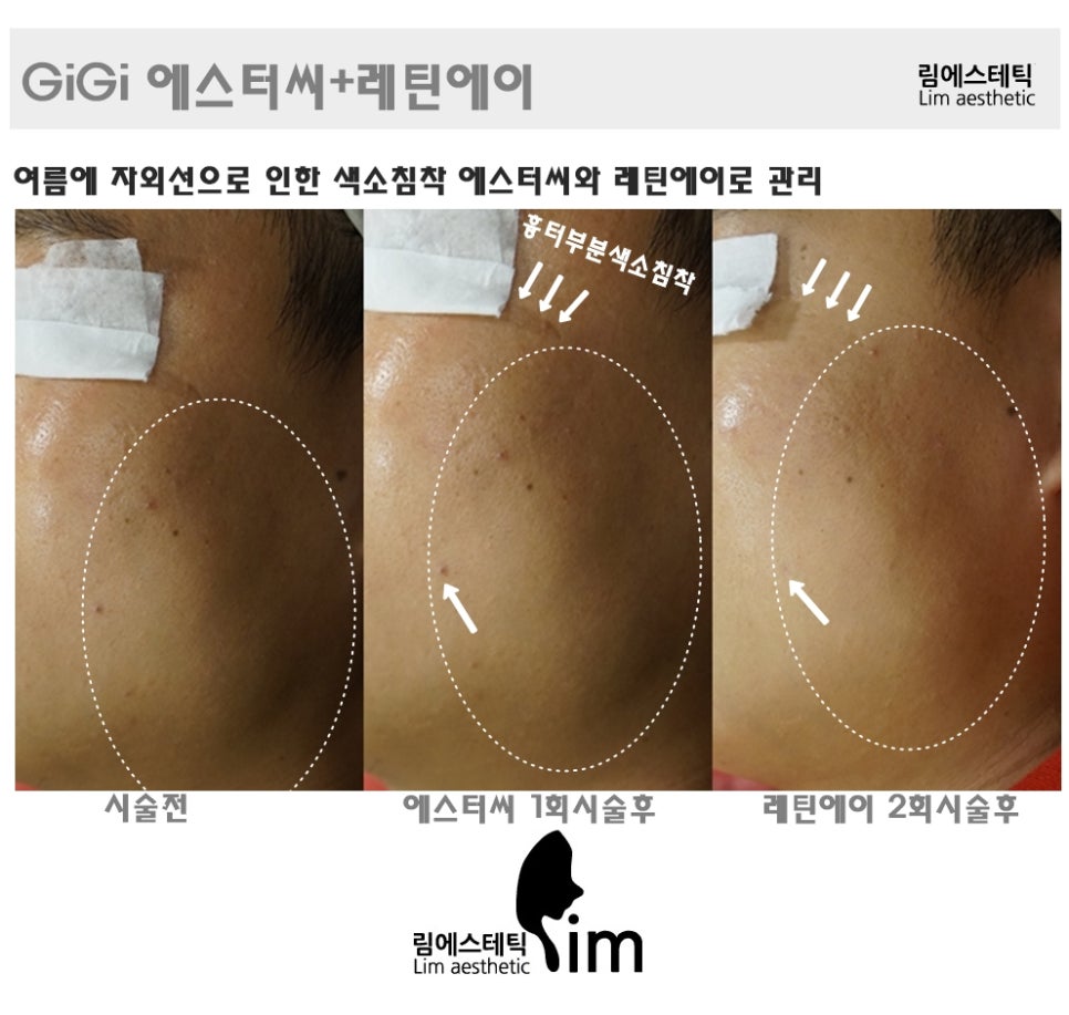 림에스테틱 이미지