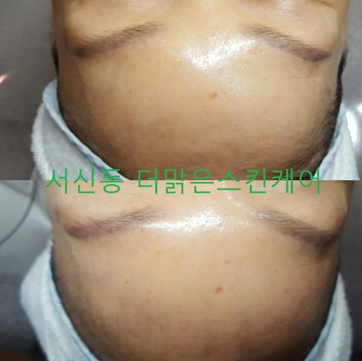 더 스킨 살롱 이미지
