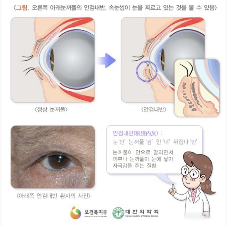 새봄안과 이미지