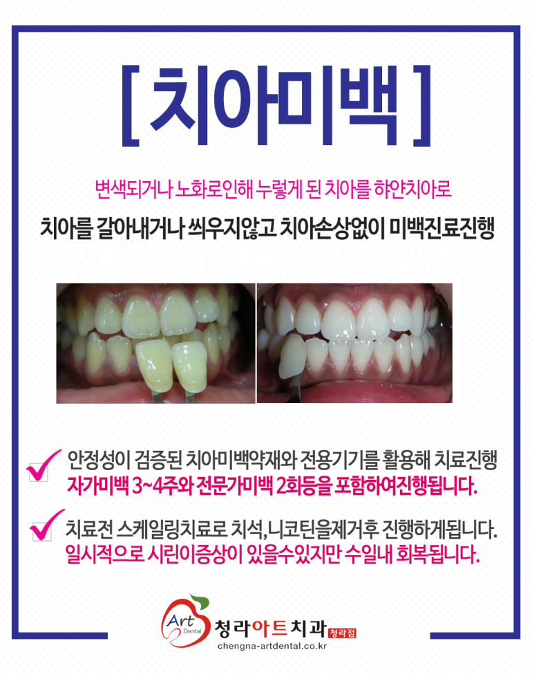 더하얀치과 이미지