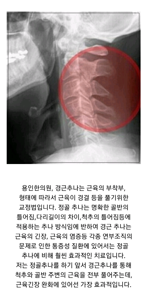 정재훈한의원 이미지