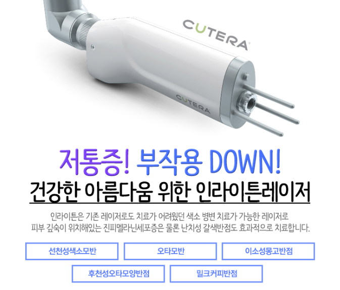몽고반점 이미지