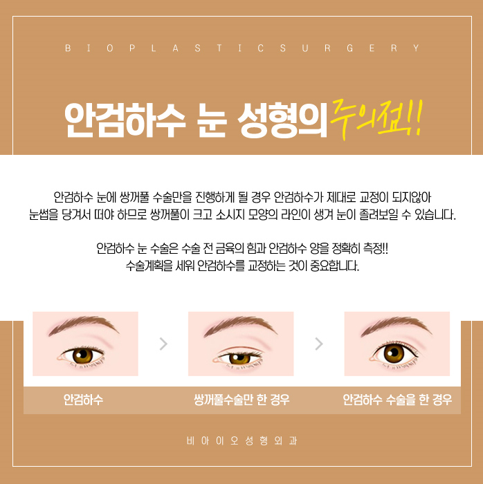 비아이오 이미지