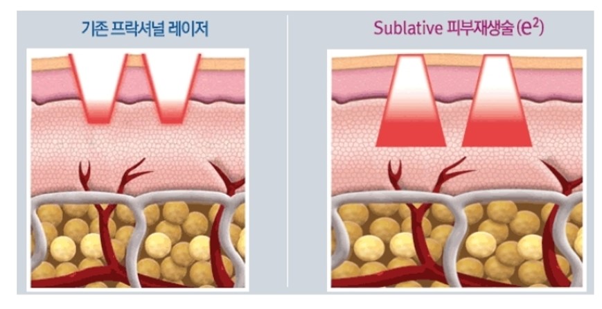 비이플러스 이미지