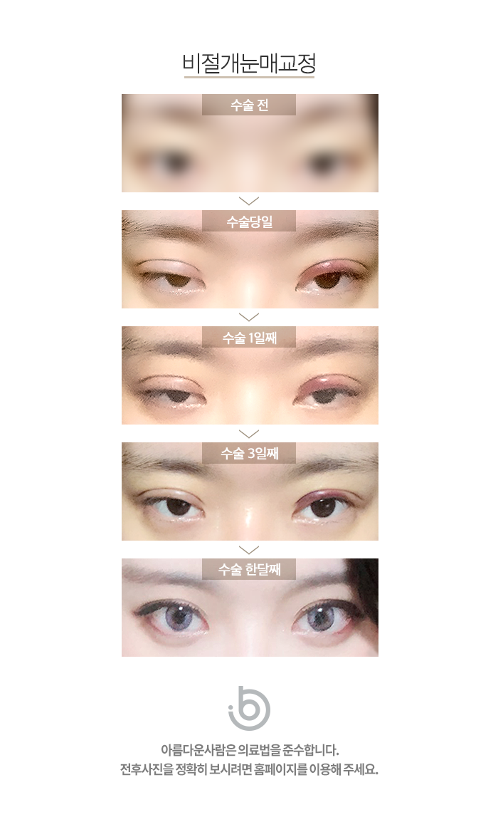 인아웃 이미지