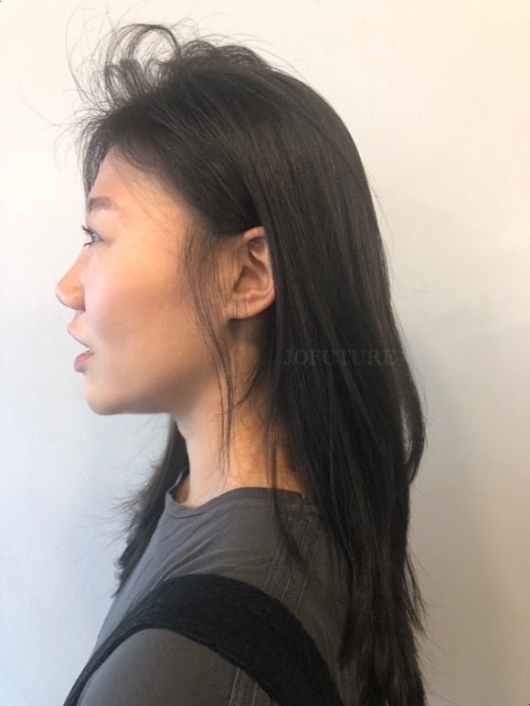 조헤어라인 이미지