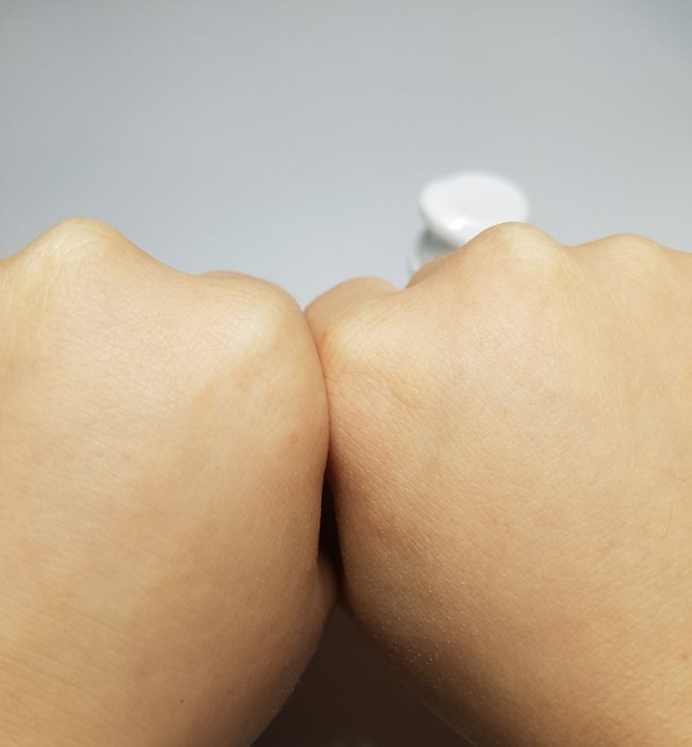 바른메디케어 이미지