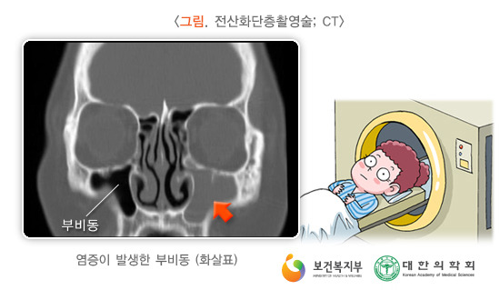 배이비인후과 이미지