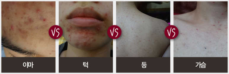 아마르한의원 이미지