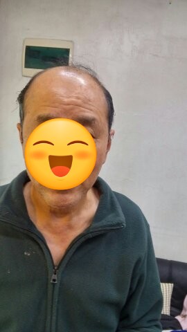 태경가발 이미지
