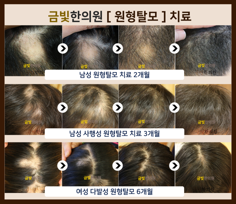 금빛한의원 이미지