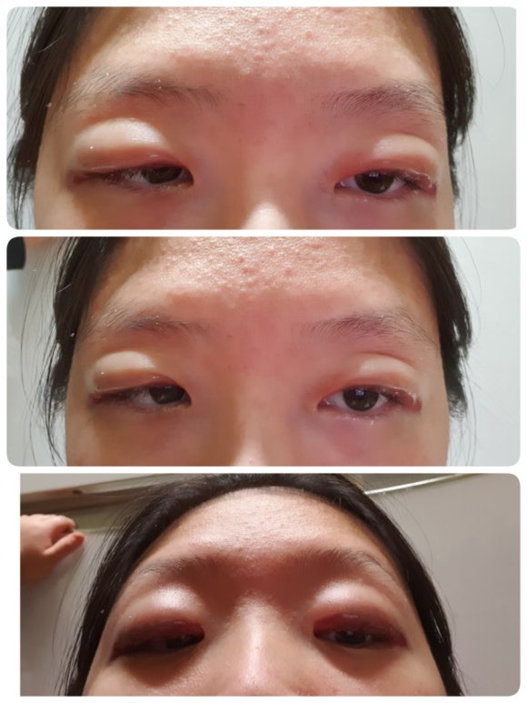둔산DS피부과 이미지