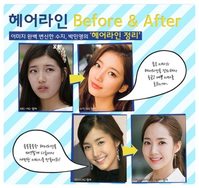 모모헤어라인 이미지