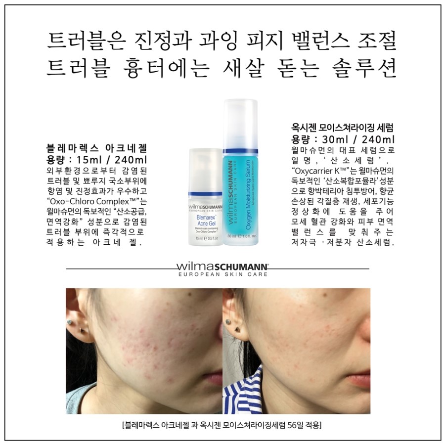 윌마 이미지