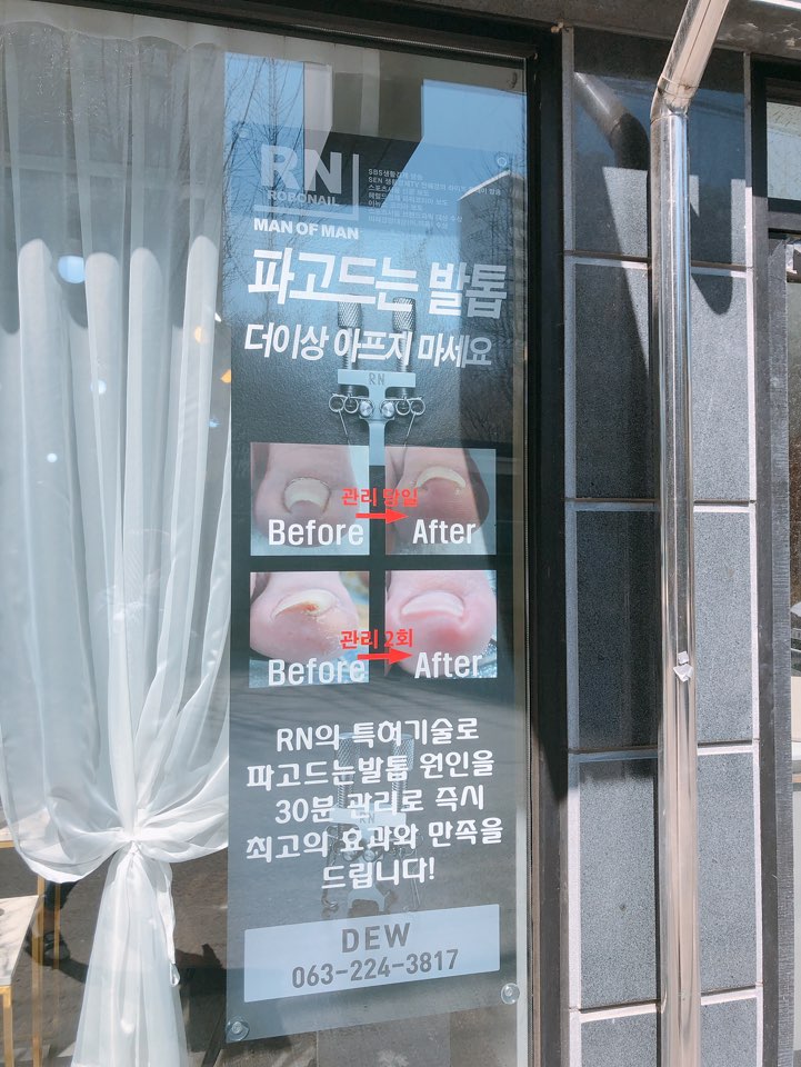 듀네일 이미지