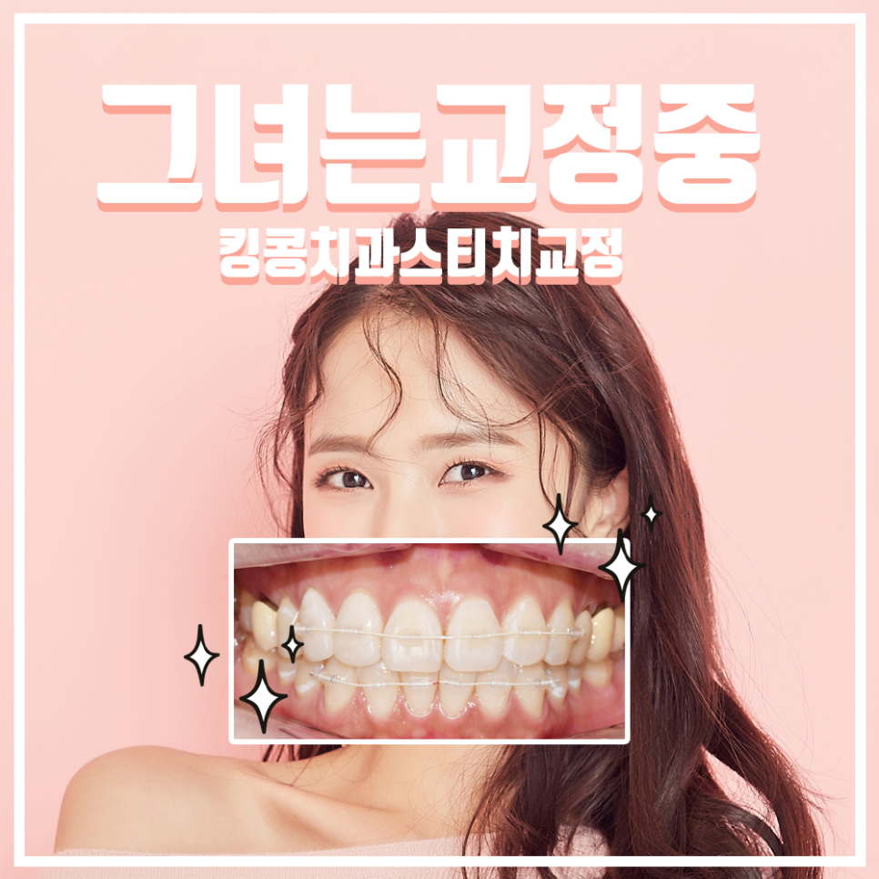 스티치킹콩 이미지