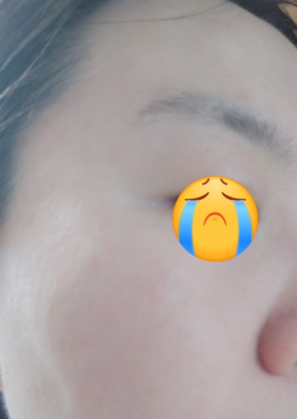 블링캣 이미지