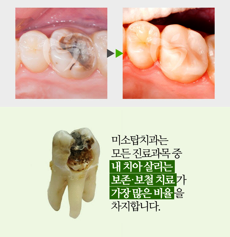 클린피씨 이미지