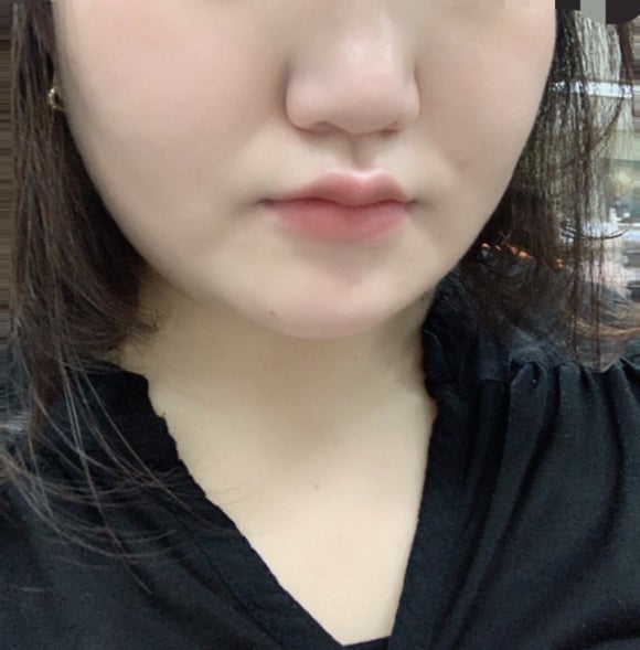 블링캣 이미지