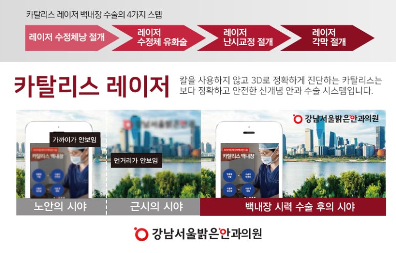 노안제일서비스 이미지