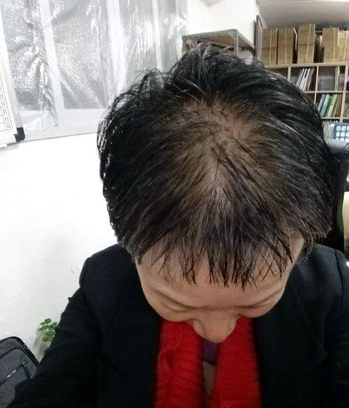 올맨 이미지