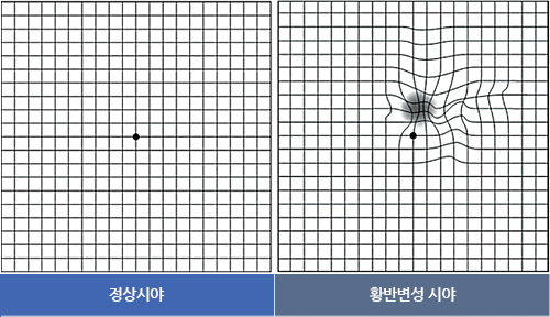 블루페퍼 안경 망원점 이미지