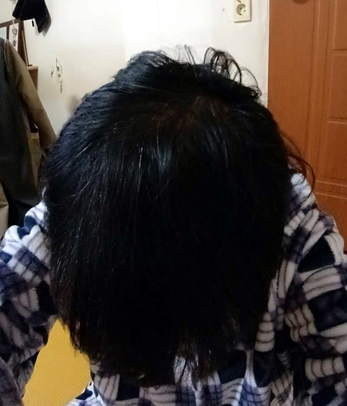 올맨 이미지